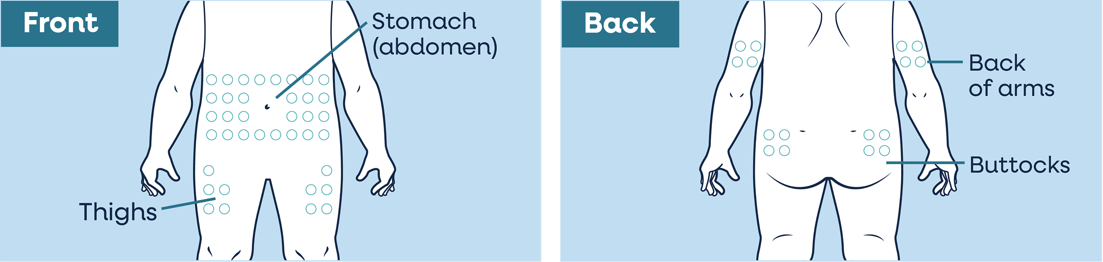 YUVIWEL where to inject map image