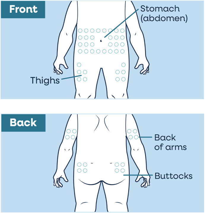 YUVIWEL where to inject map image